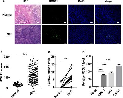 LncRNA HCG11 Facilitates Nasopharyngeal Carcinoma Progression Through Regulating miRNA-490-3p/MAP3K9 Axis